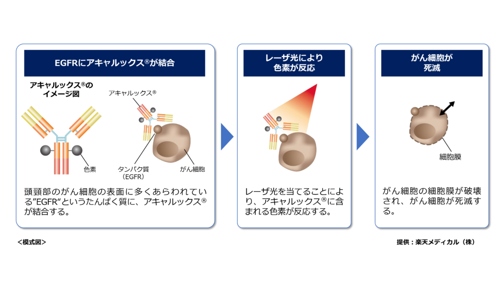 アキャルックスの作用機序が、イラストと説明文で紹介されている。説明文には、1. 頭頸部のがん細胞の表面に多くあらわれている”EFGR”というたんぱく質に、アキャルックス🄬が結合する。2. レーザー光を当てることにより、アキャルックス🄬に含まれる色素が反応する。3. がん細胞の細胞膜が破壊され、癌細胞が死滅する。と書かれている。